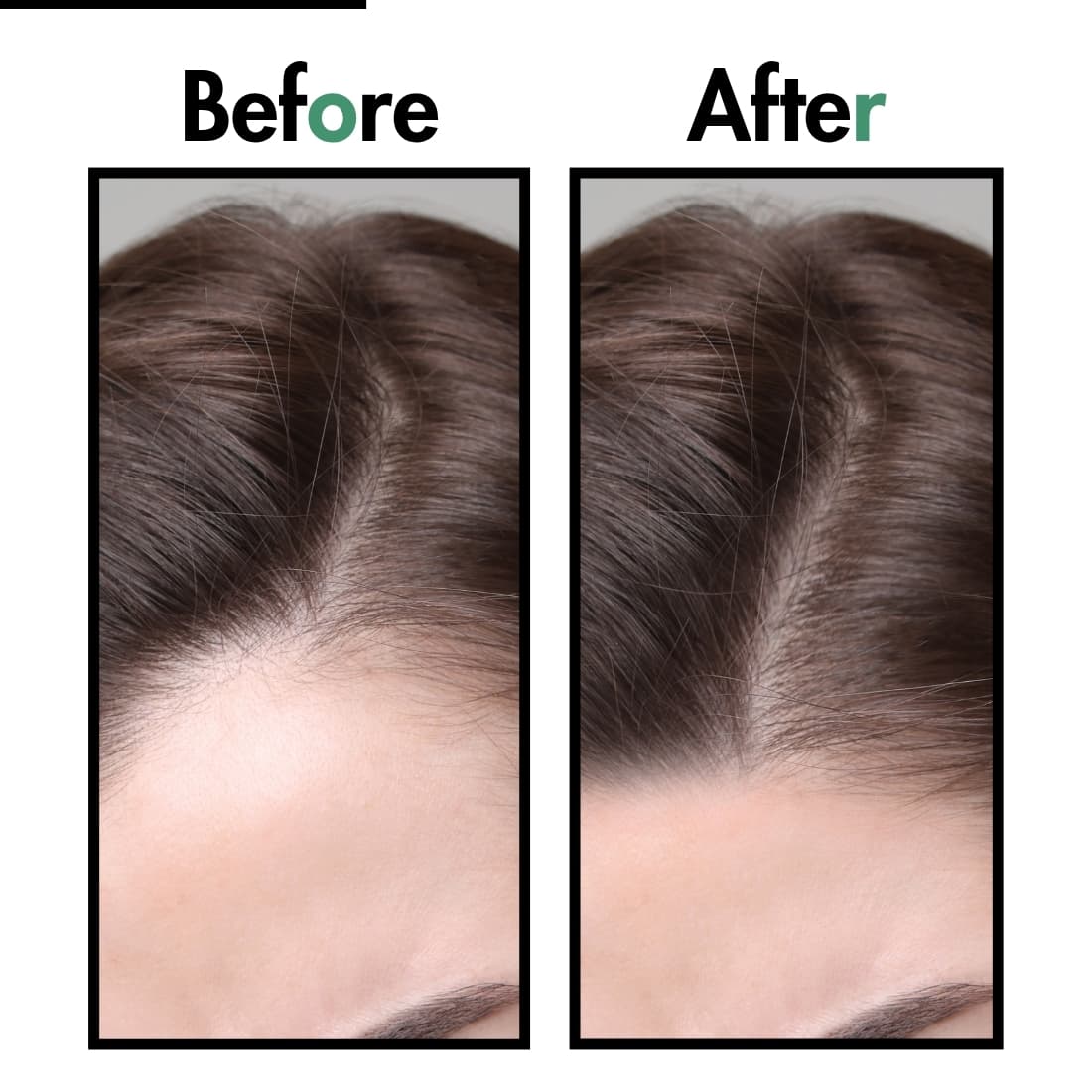 Sahini Herbal Hair Growth & Scalp Revitalizing Oil 100ml Photo 3